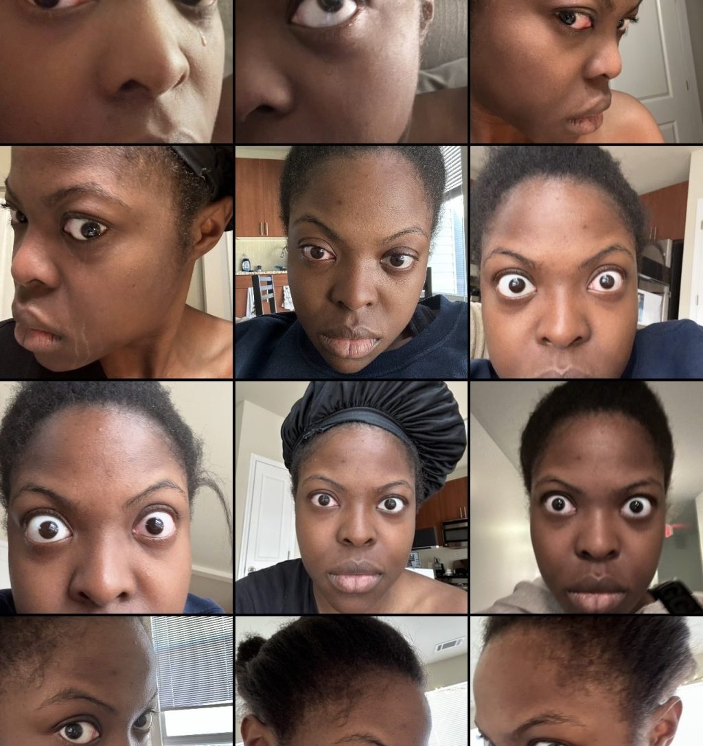 TRIGGER WARNING: CONJUCTIVITIS